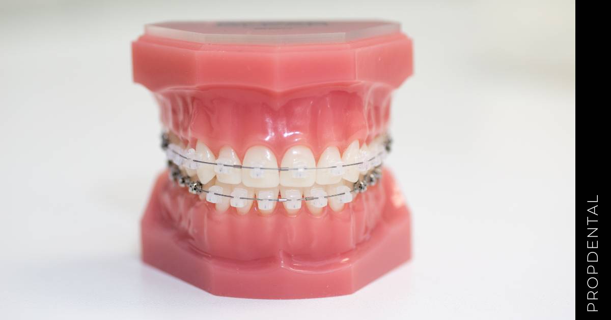 El movimiento en ortodoncia