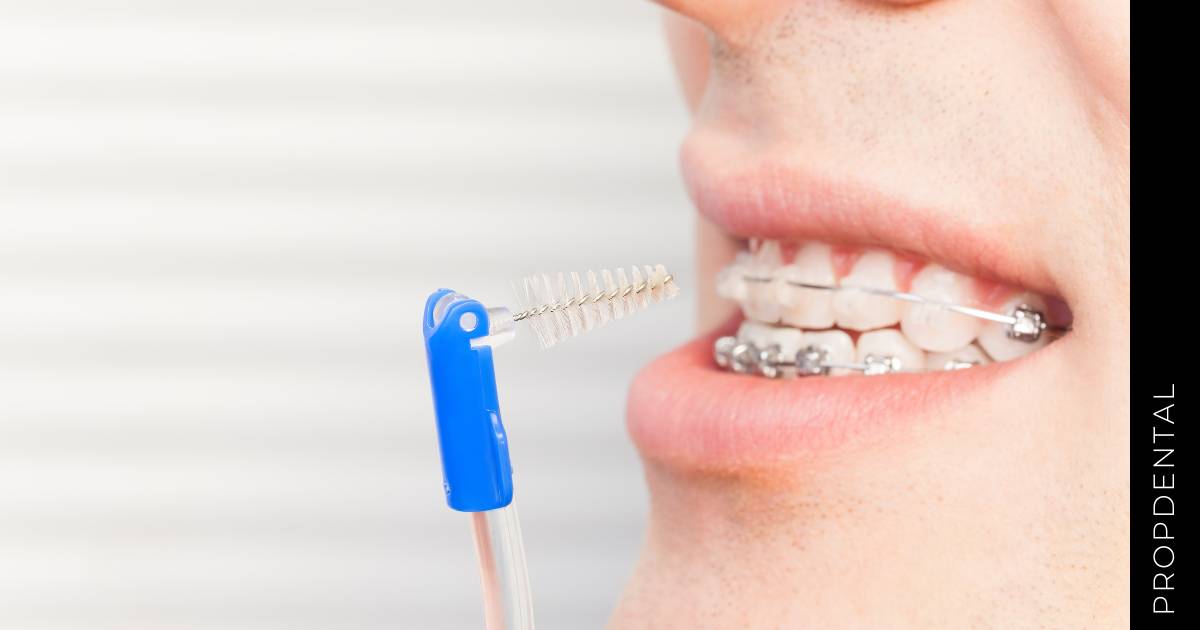 Es doloroso el tratamiento de ortodoncia | Preguntas frecuentes