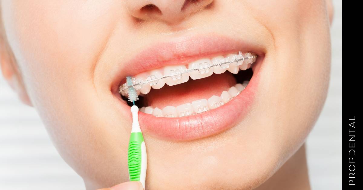 Higiene para pacientes con ortodoncia