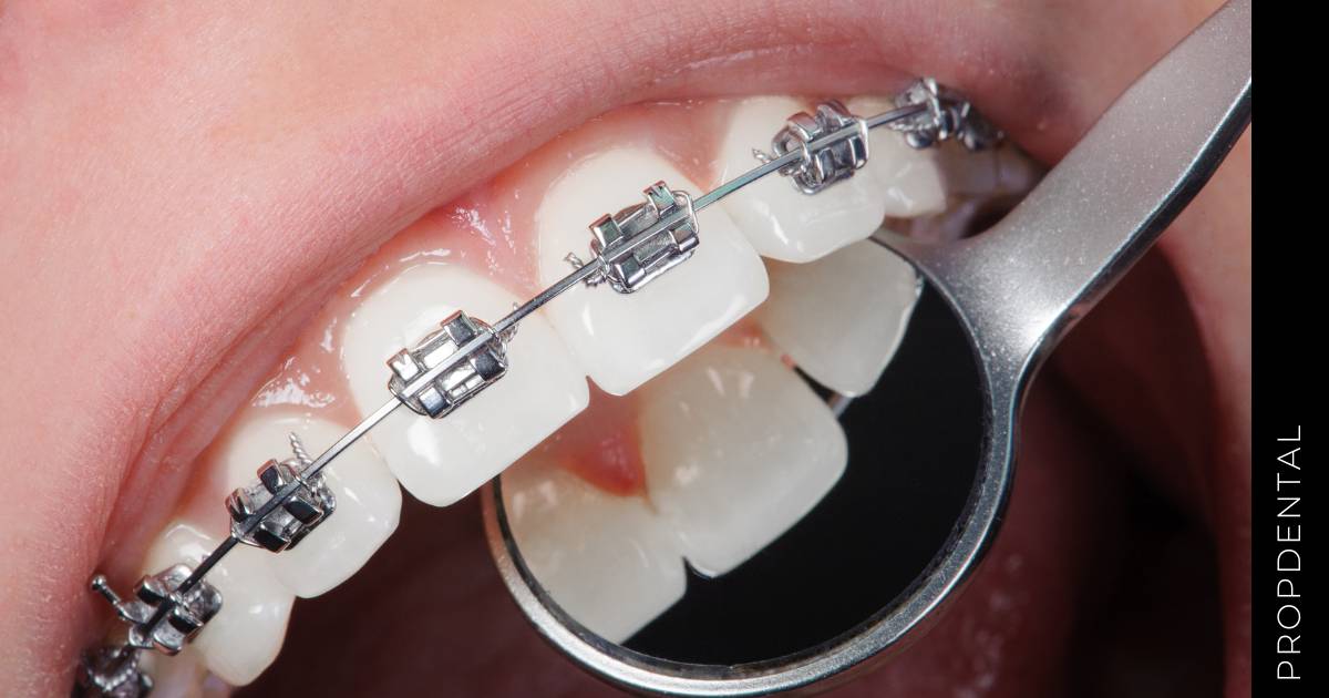Preguntas de ortodoncia