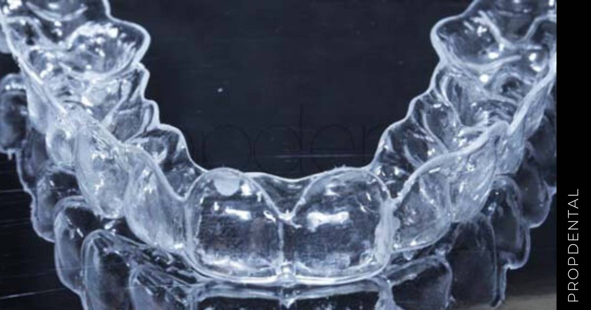 Retenedor de ortodoncia roto