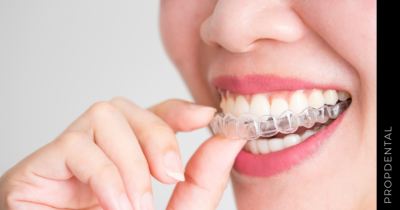 Invisalign Moderate